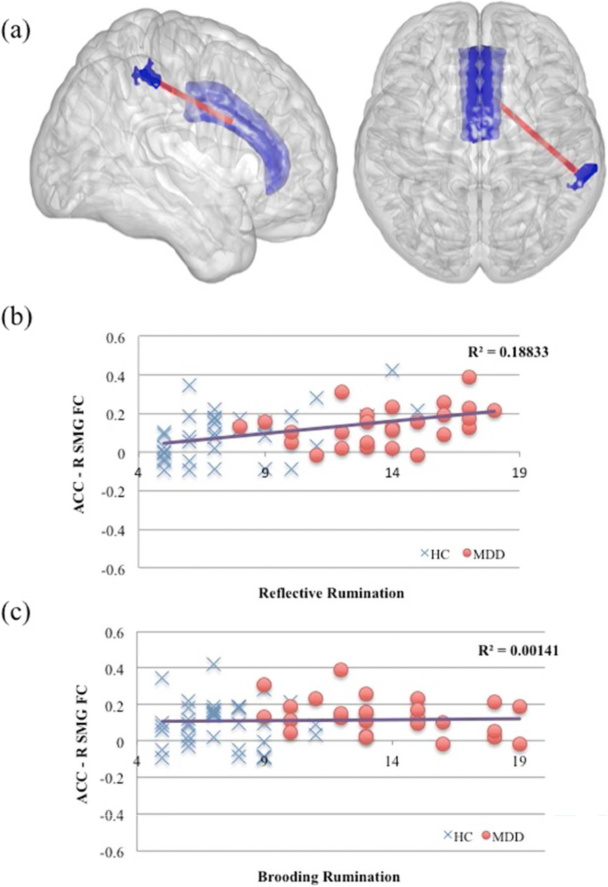 The image consists of three main parts labeled (a), (b), and (c). Part (a) shows two 3D brain models with highlighted areas in blue and red, indicating specific regions and connections. Part (b) is a scatter plot titled 'Reflective Rumination' with axes labeled 'ACC - R SMG FC' and numerical values ranging from -0.6 to 0.6. It includes data points represented by blue crosses for 'HC' and red circles for 'MDD', with a trend line and an R-squared value of 0.18833. Part (c) is another scatter plot titled 'Brooding Rumination' with similar axes and data point representations, showing an R-squared value of 0.00141.