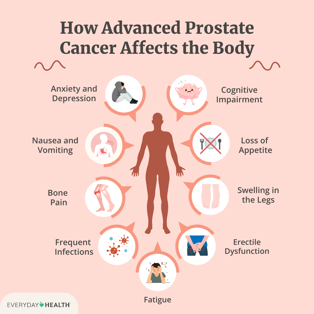 The image is an infographic titled 'How Advanced Prostate Cancer Affects the Body.' It features a central silhouette of a human body surrounded by various icons and text describing symptoms associated with advanced prostate cancer. The symptoms listed include Anxiety and Depression, Cognitive Impairment, Nausea and Vomiting, Loss of Appetite, Bone Pain, Swelling in the Legs, Frequent Infections, Erectile Dysfunction, and Fatigue. Each symptom is represented by an illustrative icon. The background is a light pink color, and the infographic is branded with 'EVERYDAY HEALTH' at the bottom left corner.